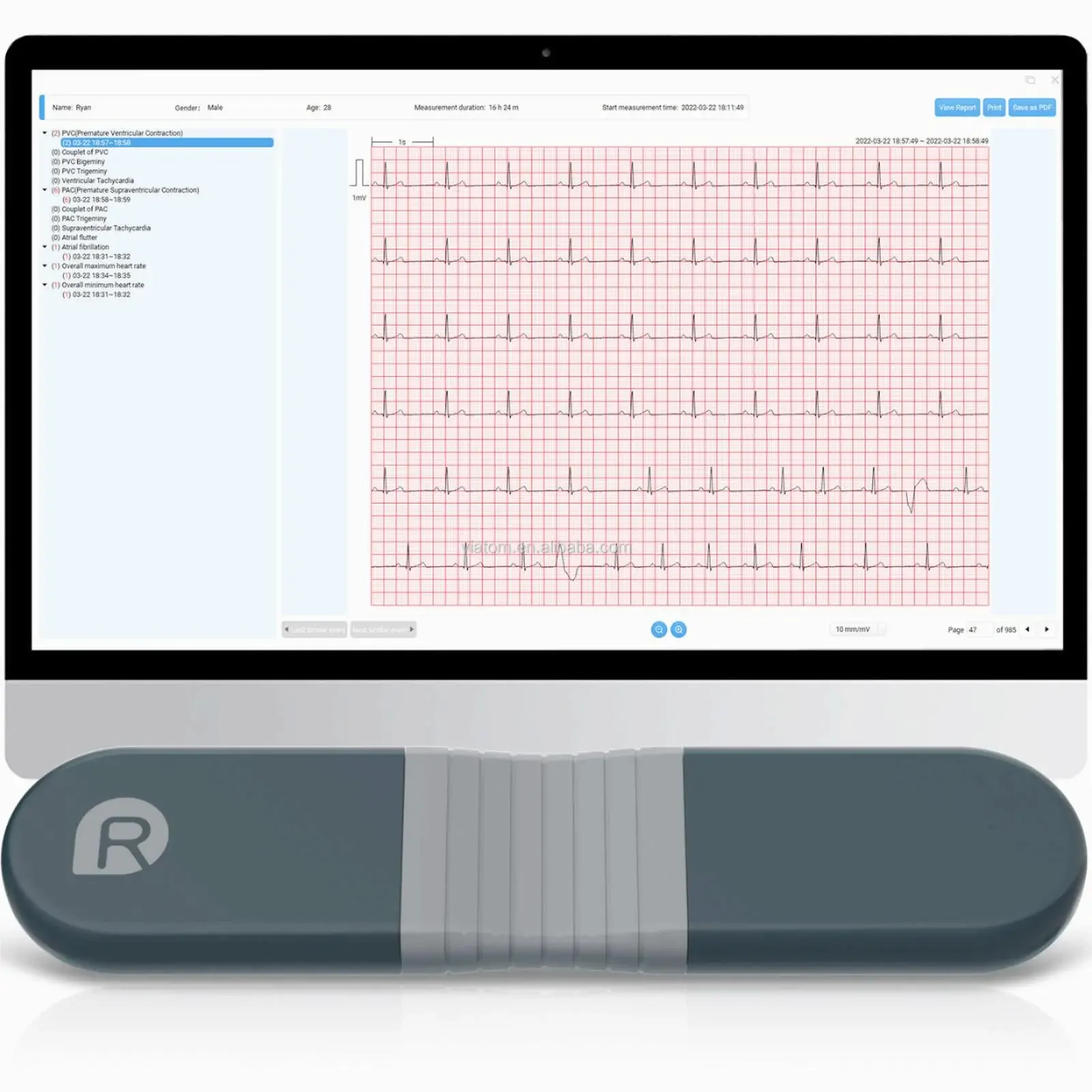 ワイヤレス Bluetooth ダイナミック レコーダー リ - Ecg Patch Monitor のレビューと価格